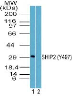 Western Blot: SHIP2/INPPL1 [p Tyr497] Antibody [NBP2-24461]